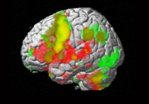 brain